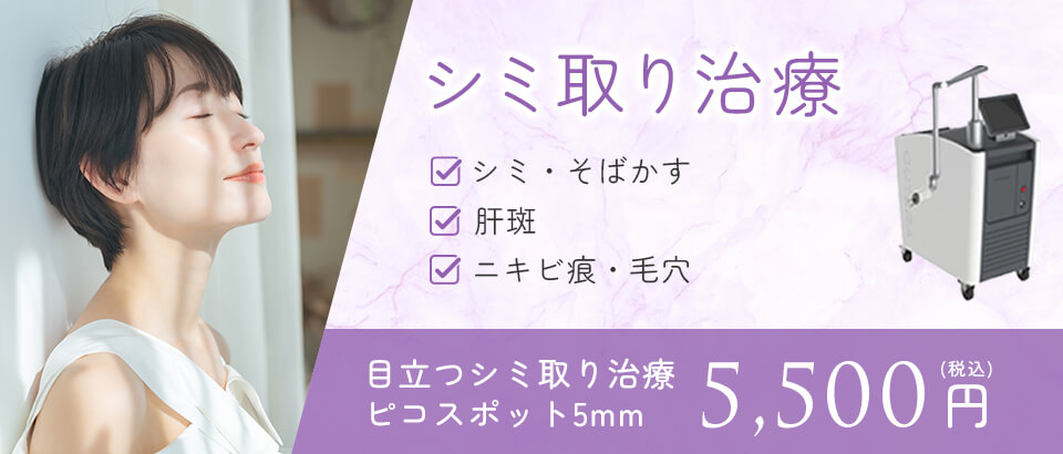 シミ取り治療バナー