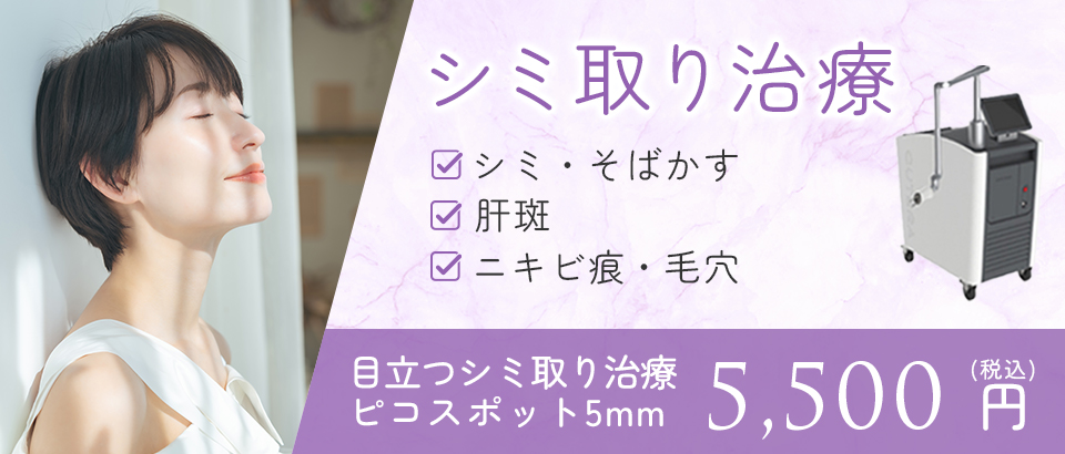 シミ取り治療バナー