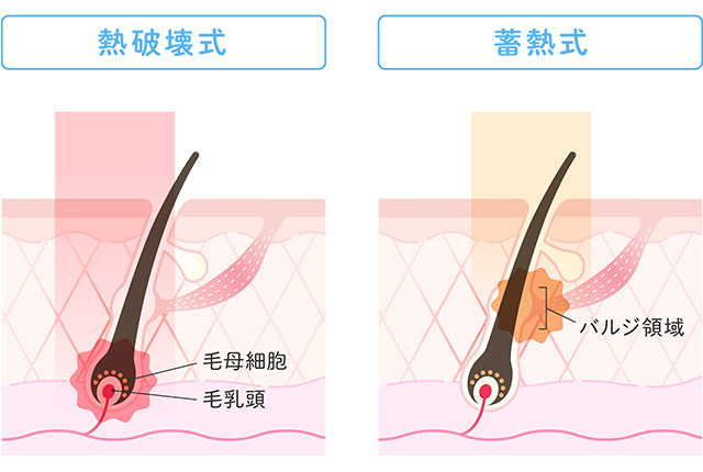 熱破壊式と蓄熱式の比較図